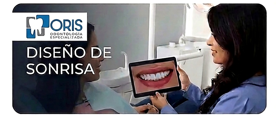 Diseño de Sonrisa ORIS